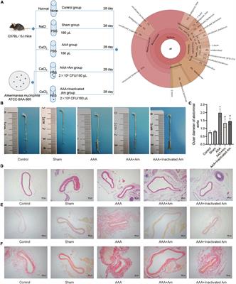 Akkermansia muciniphila Alters Gut Microbiota and Immune System to Improve Cardiovascular Diseases in Murine Model